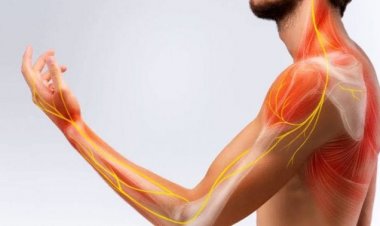 أعراض التهاب الأعصاب