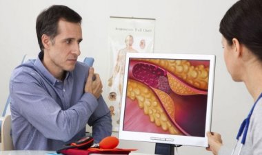 أعراض الكوليسترول … هل تُدرك مدى خطورته على صحتك؟