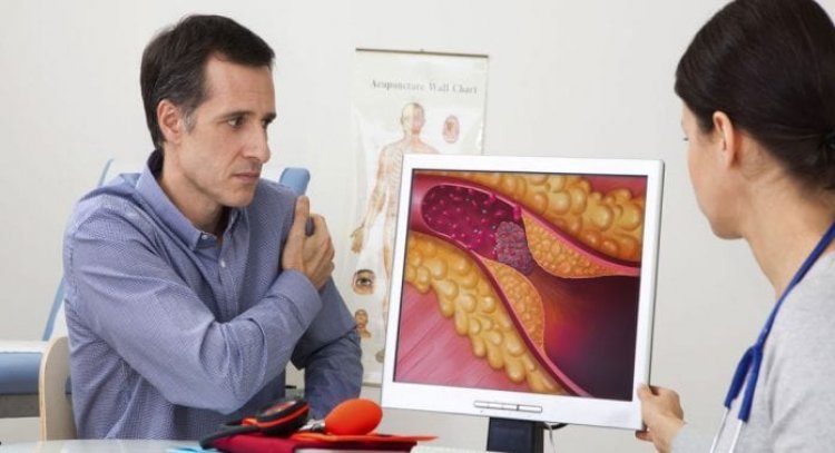 أعراض الكوليسترول … هل تُدرك مدى خطورته على صحتك؟