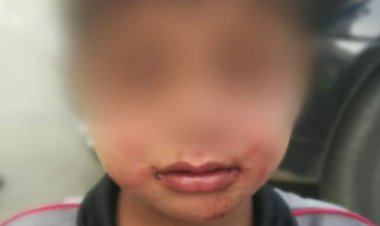 بسبب انزعاجه من بكاء طفله.. قام بتعنيفه فنُقِل إلى المستشفى