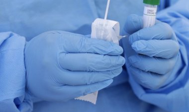 نائبة روسية تربط بين تفشي جدري القردة ونشاط المختبرات البيولوجية الأمريكية