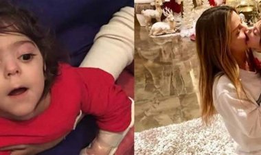 نقابة الاطباء تكشف الحقيقة: الطفلة صوفي مشلب ضحية خطأ طبي
