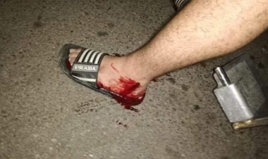 معلومات عن إصابة شاب باطلاق نار بمحيط مركز التيار الوطني الحر في ميرنا الشالوحي