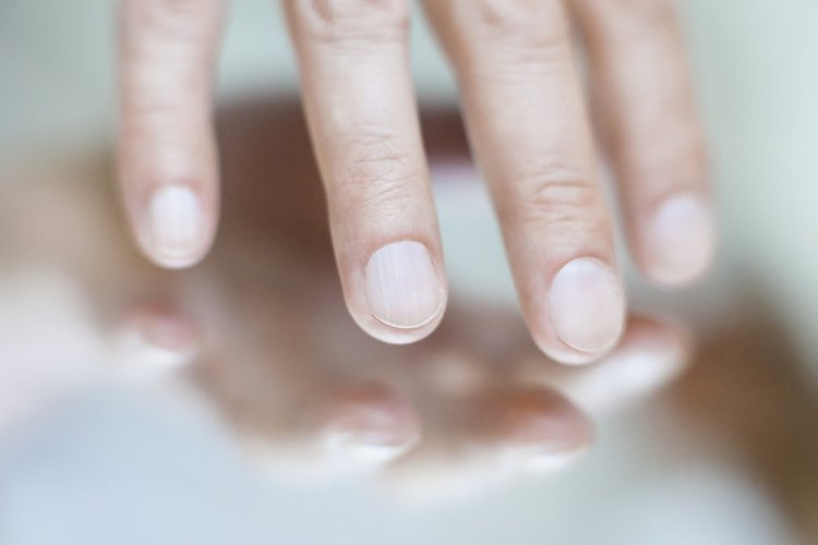 علامات على الجلد والأظافر لنقص "فيتامين ب 12"