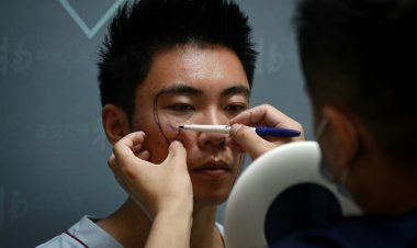 عمليات التجميل تستهوي الرجال في الصين