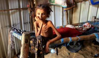 سيطرة شبح الجوع على العالم العربي