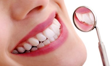 لماذا تظهر لدى البعض بقع بيضاء عنيدة على أسنانهم ولا تختفي أبدا؟