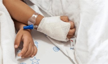 اليابان تكشف عن أول إصابة بمرض التهاب الكبد الغامض لدى الأطفال