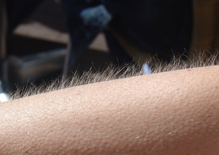 ما هي أسباب القشعريرة الجسدية ؟