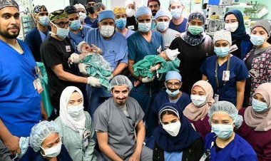 فريق طبي سعودي ينجح بفصل توأم سيامي يمني